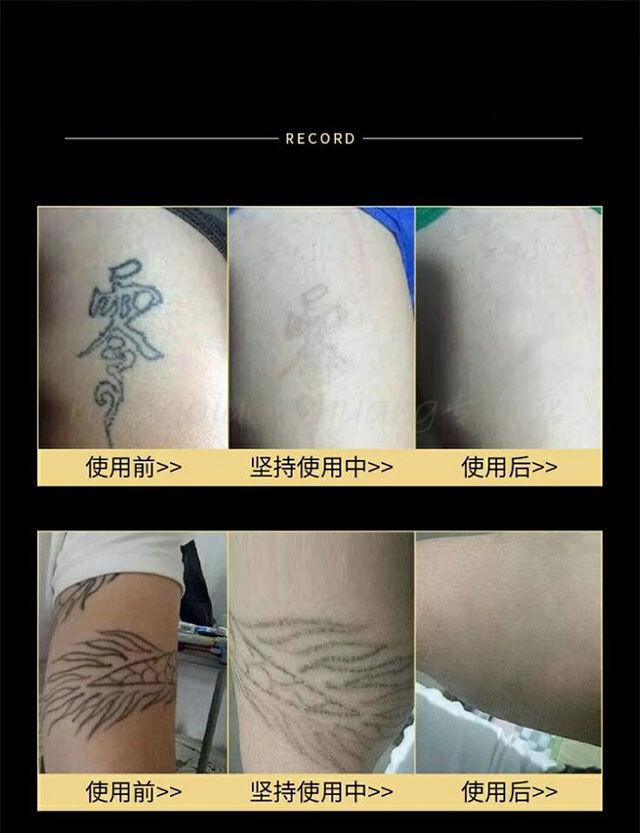 快速洗i纹身洗纹眉无痛洗纹身药水激光去i纹身脱色剂男女通用效果体验