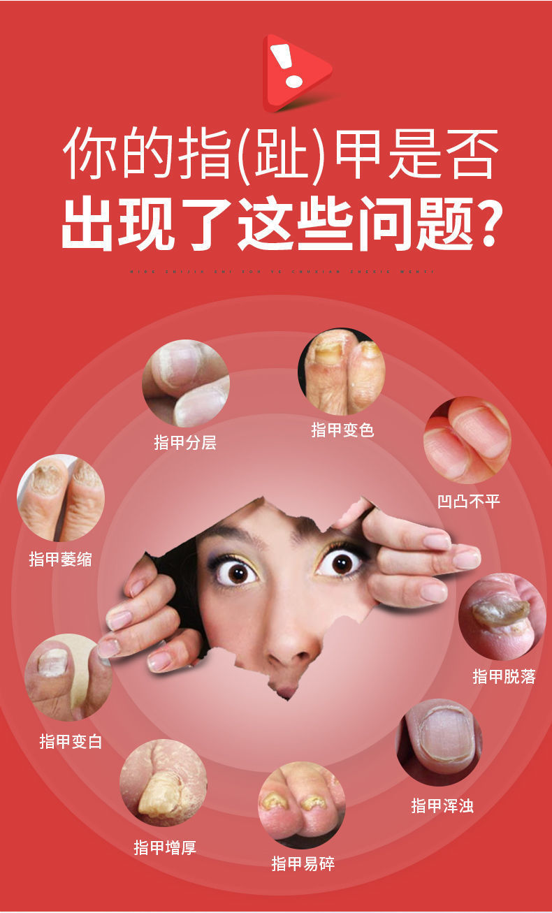 南京同仁堂灰指甲脱甲液专用灰指甲快速去甲沟炎软甲增厚2盒装同仁堂