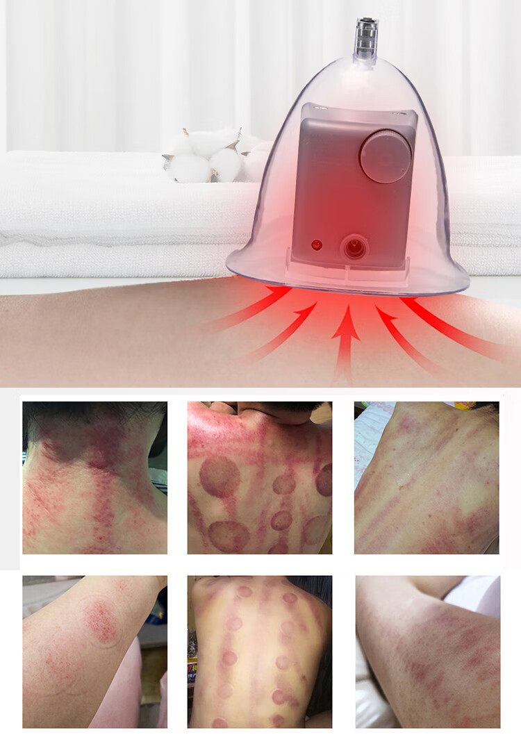 京健康碧波挺庭养生仪器内在负压家用按摩拔罐胸部神器注氧刮痧养生版