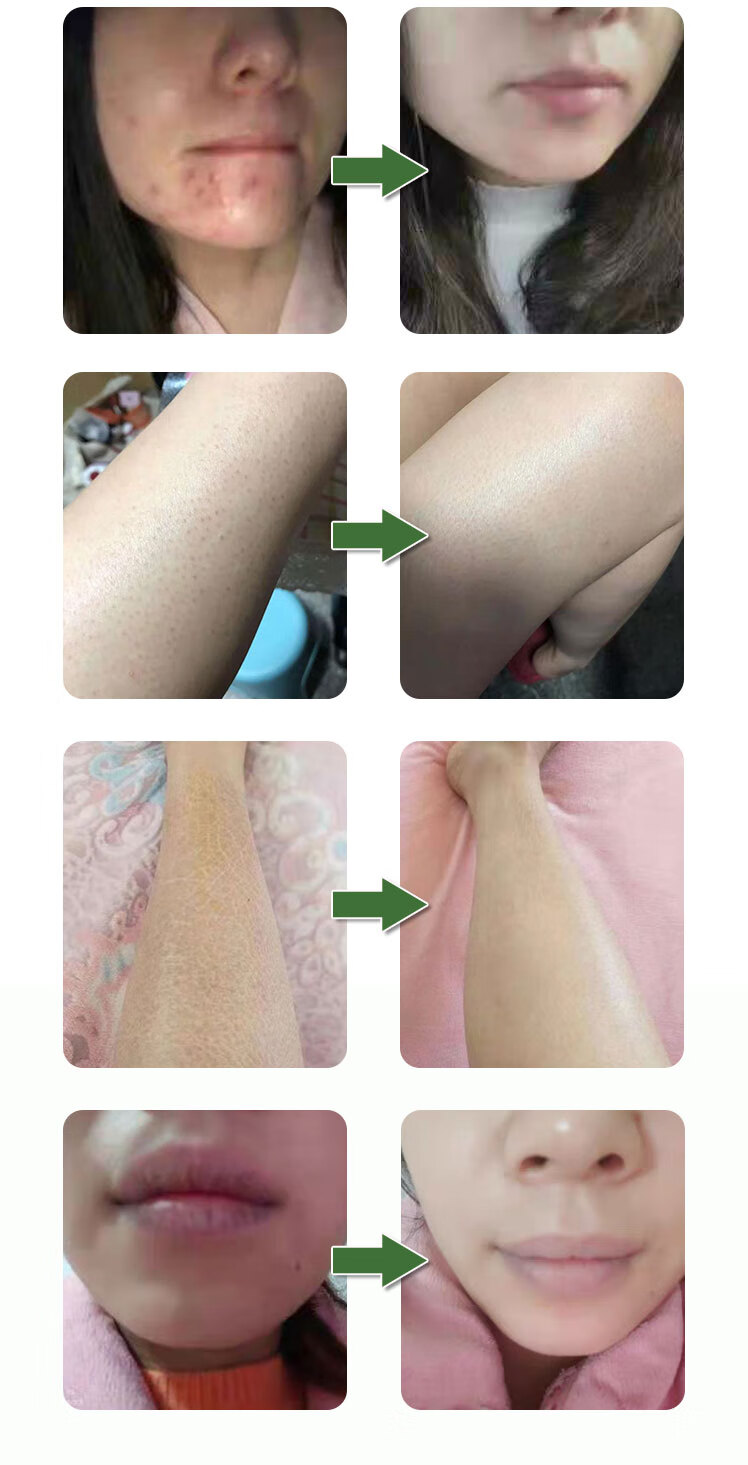 【官方旗舰】佰芙芷紫参膏百芙芷止紫参膏佰肤芙夫芷紫参膏(一盒装)