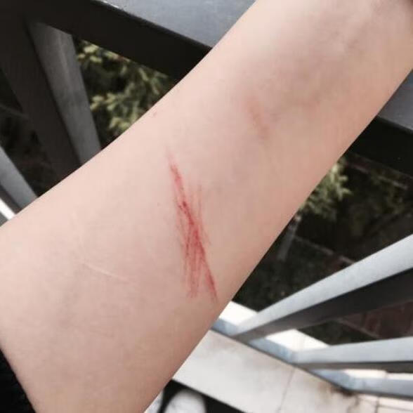 伤疤贴纸纹身贴防水男女万圣节恐怖伤疤缝针仿真恶作剧假受伤口抓痕