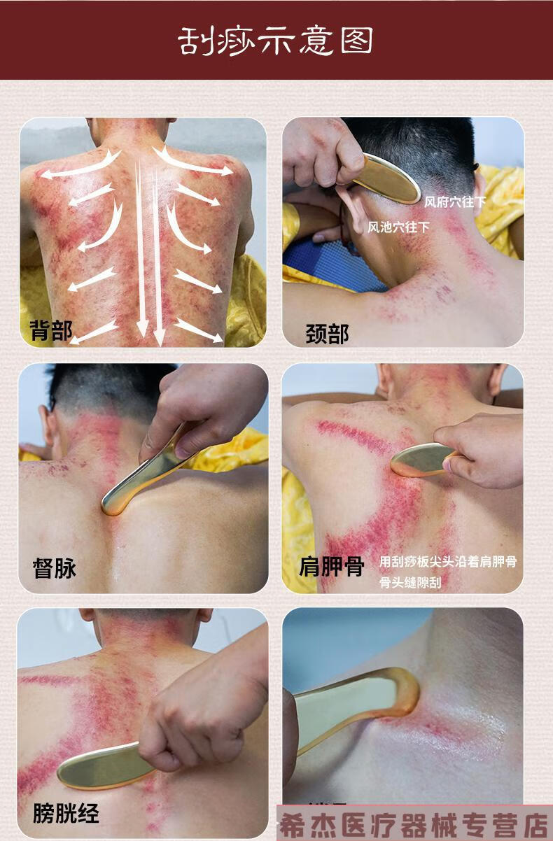 问痧堂纯黄铜刮痧板纯铜制李氏虎符砭法李道政手工全身刮痧刀中号款赠
