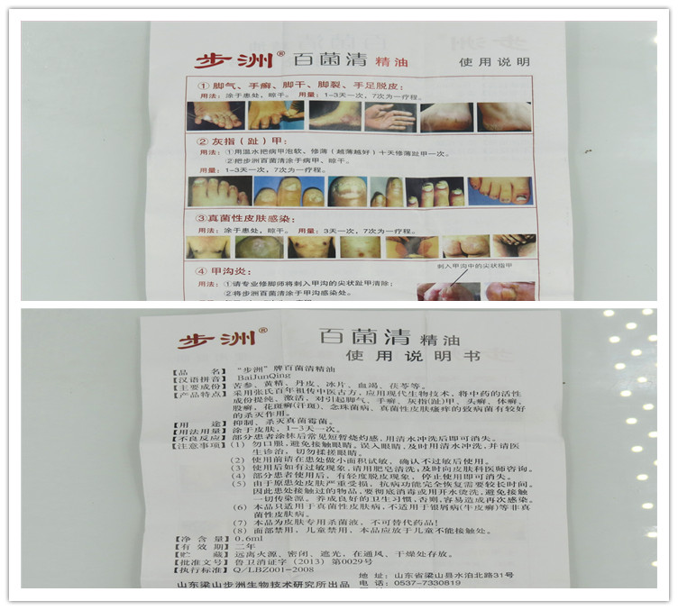 步洲百菌清特级精油真菌性皮肤感染脚裂手脚脱皮sn1支