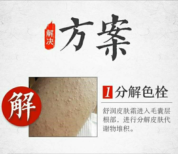 鱼鳞病皮肤霜祛蛇皮肤克星去鸡皮肤毛囊角质疙瘩小腿腿部干燥脱皮1盒