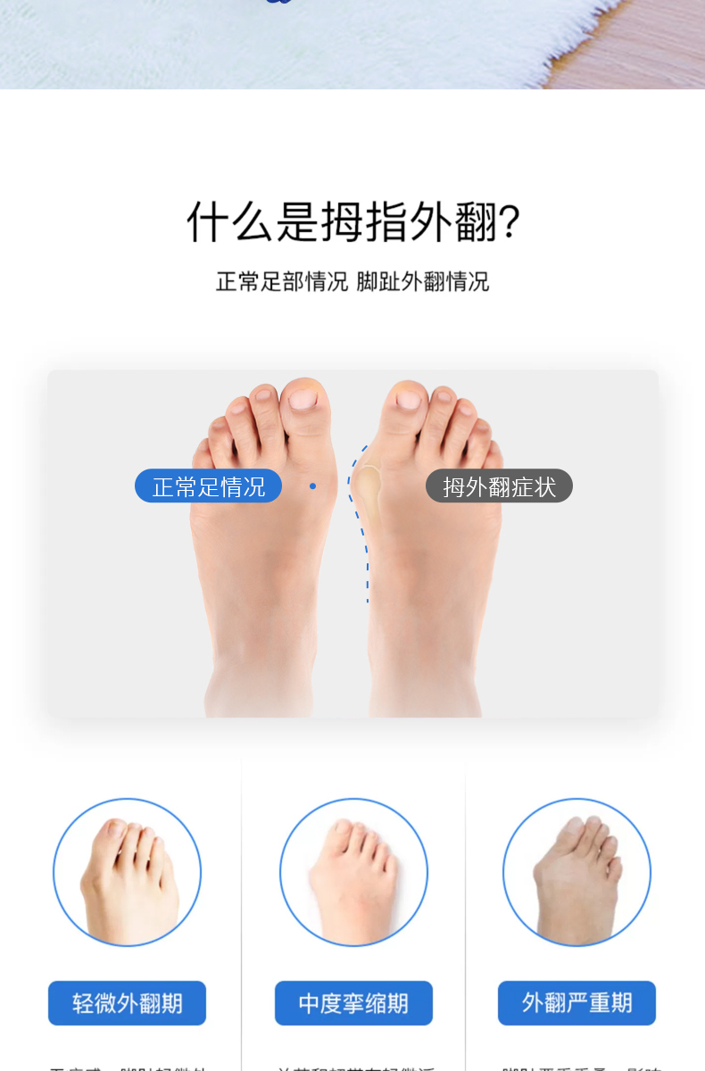 【德国技术 大脚骨纠正】大拇指外翻纠正器德国大脚趾拇指器分大母