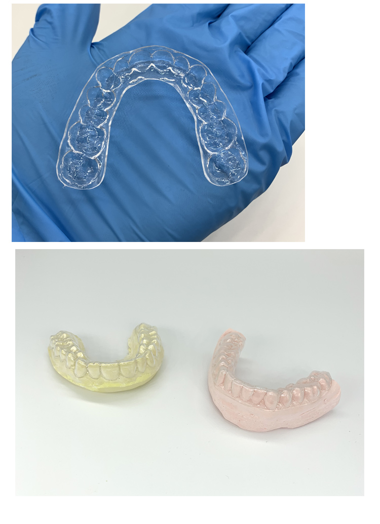 隐形牙套 定制透明保持器成人牙套隐形矫正压膜片大人儿童纠正牙齿
