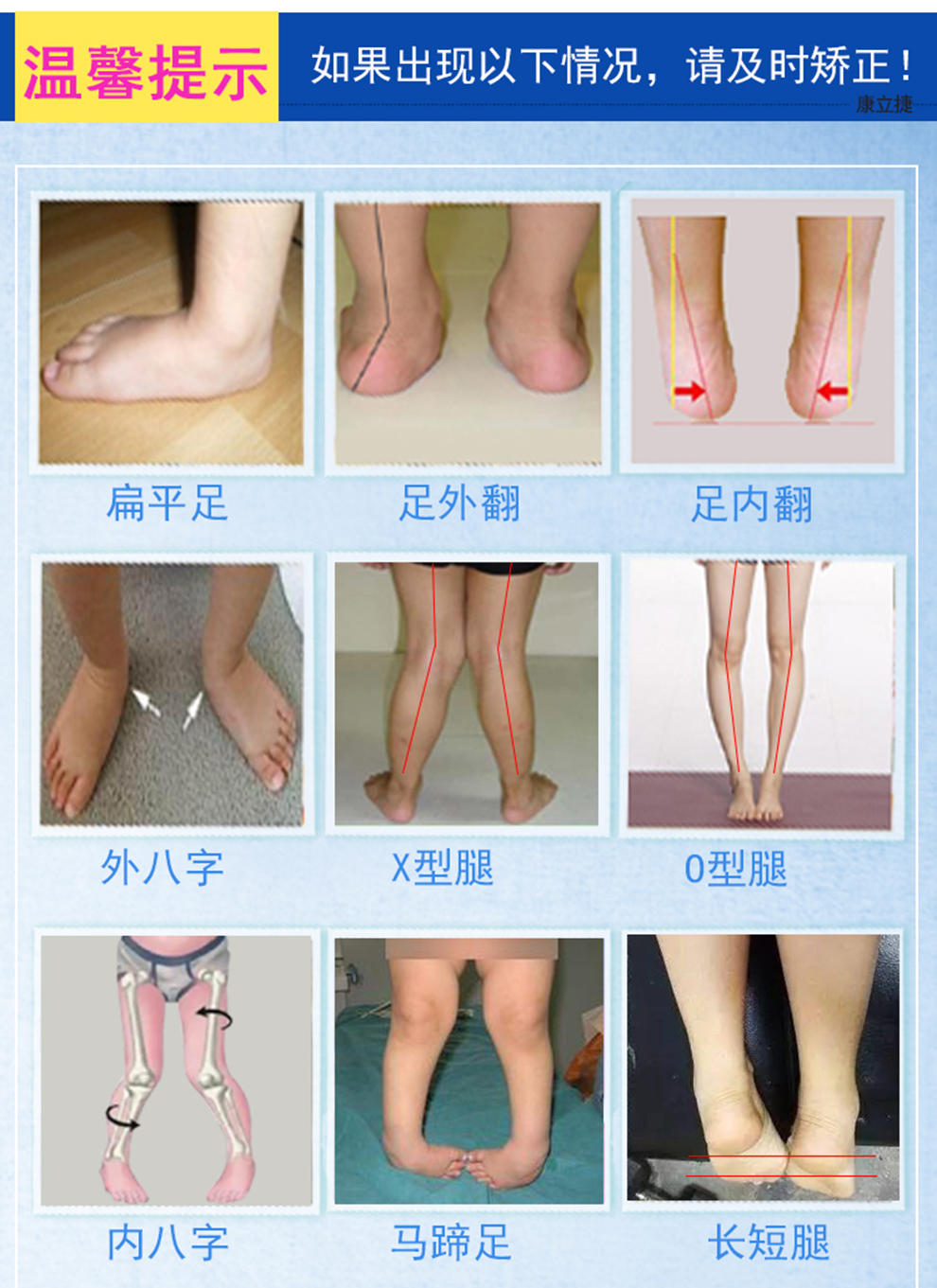 康立捷 专业定做儿童宝宝足下垂马蹄足内外翻矫正鞋小孩内外八字脚