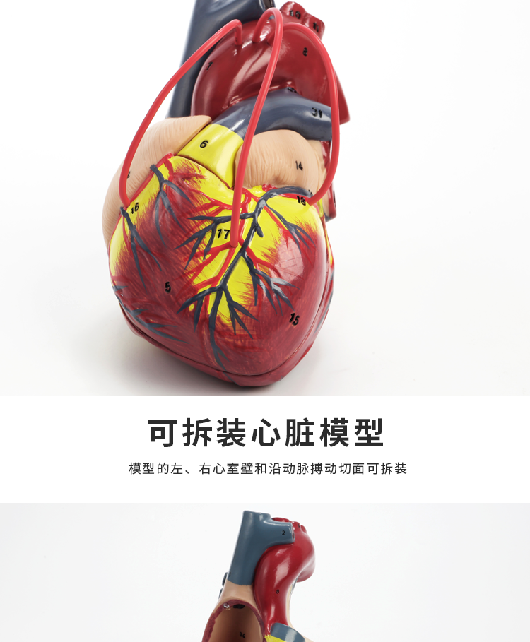 5倍心脏搭桥模型-送图解 34个数字标识【图片 价格 品牌 报价】-京东