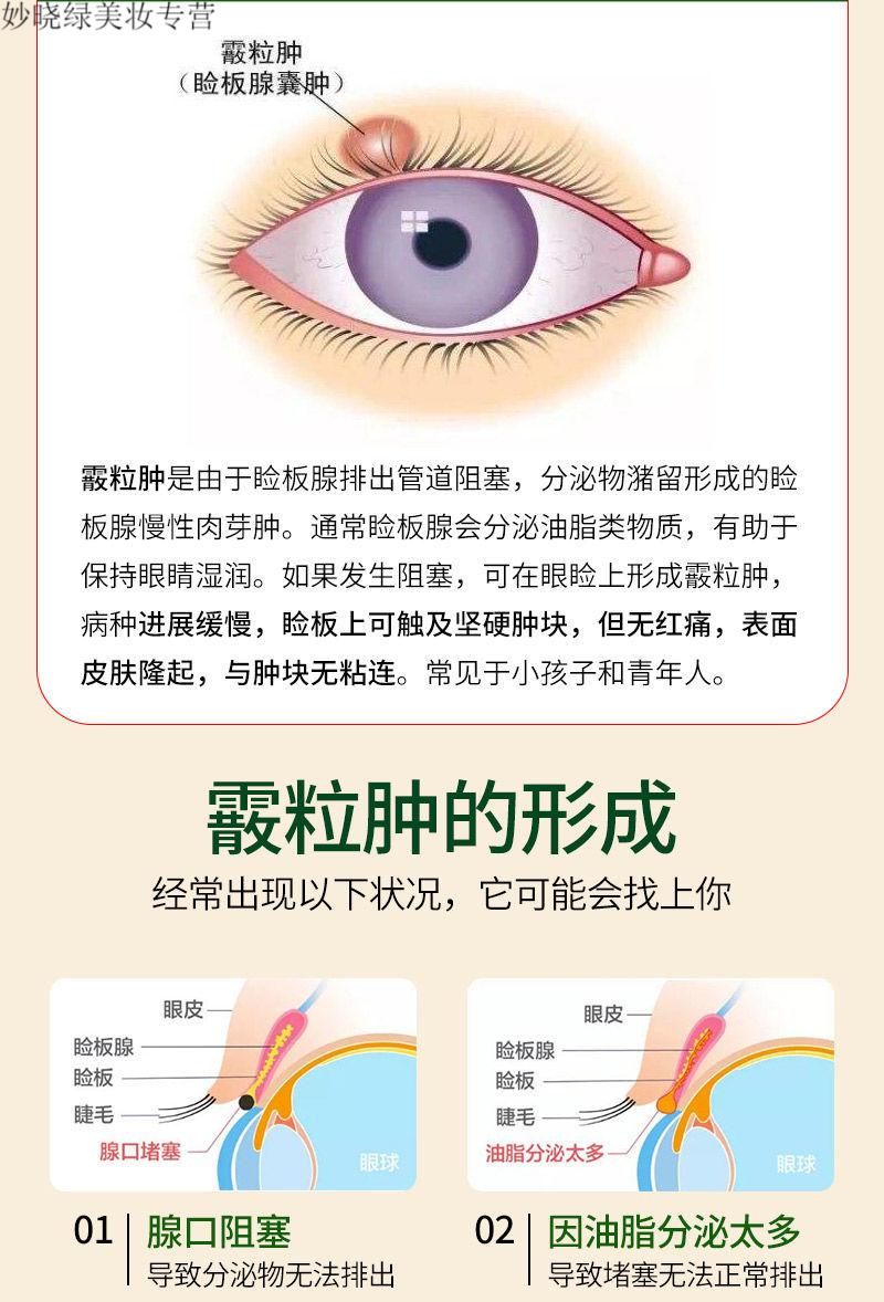 【直接涂抹建议早用】麦粒肿撅眼针睑腺炎红肿流脓疼痛眼疖子沙眼 1盒