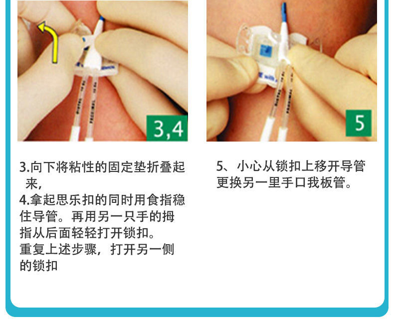 妥能蝴蝶型体表导管固定装置思乐扣picc导管固定器胆汁引流固定贴 思