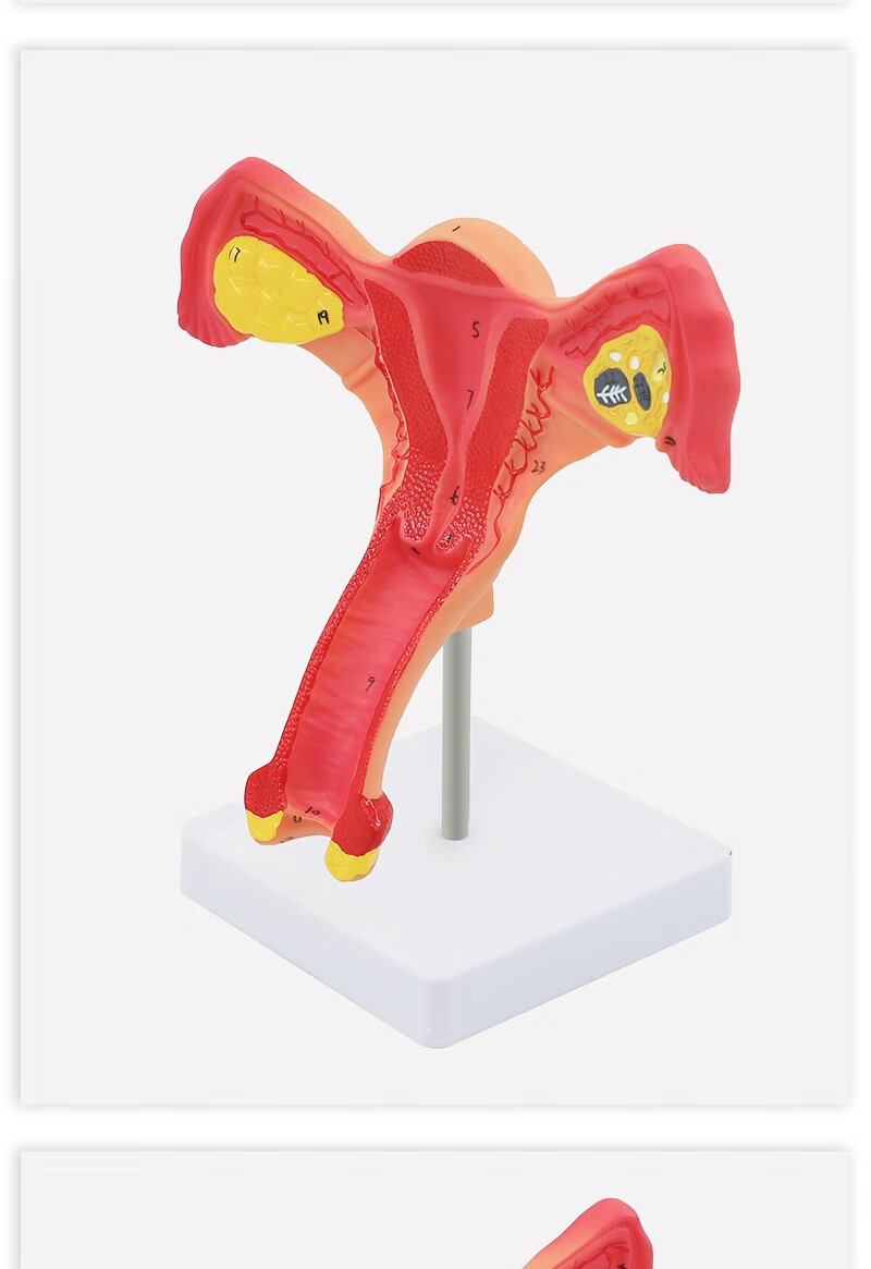 妙灵安 医学女性盆腔解剖模型生殖泌尿系统标本子宫妇科盆骨教学演示