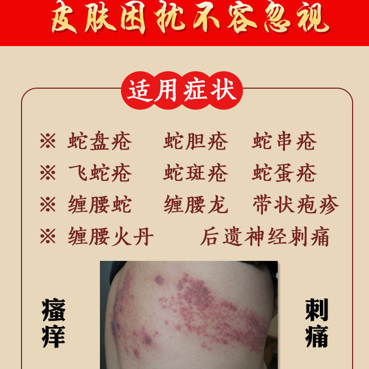 加丹一号克优膏治带状后遗症神经痛清病毒缠腰龙蛇胆疮膏买54祛根装