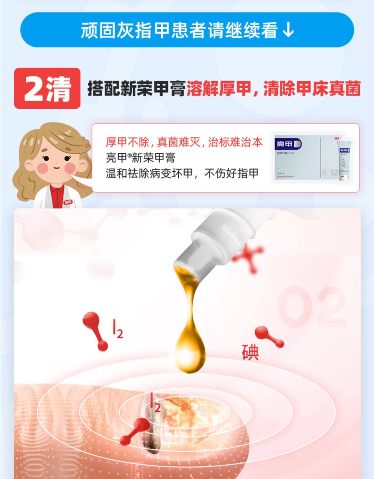 亮甲复方聚维酮碘搽剂3ml2瓶灰指甲专用用于足癣体癣头癣花斑癣手癣1