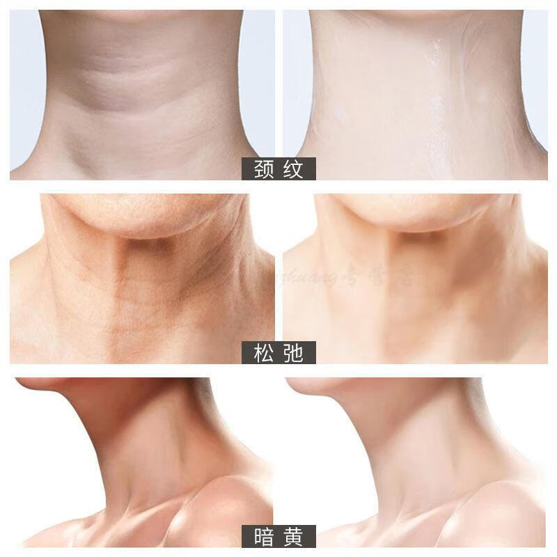 多肽凡士林嫩白颈霜提拉紧致男女学生颈部护理颈膜三支多肽美i白颈霜
