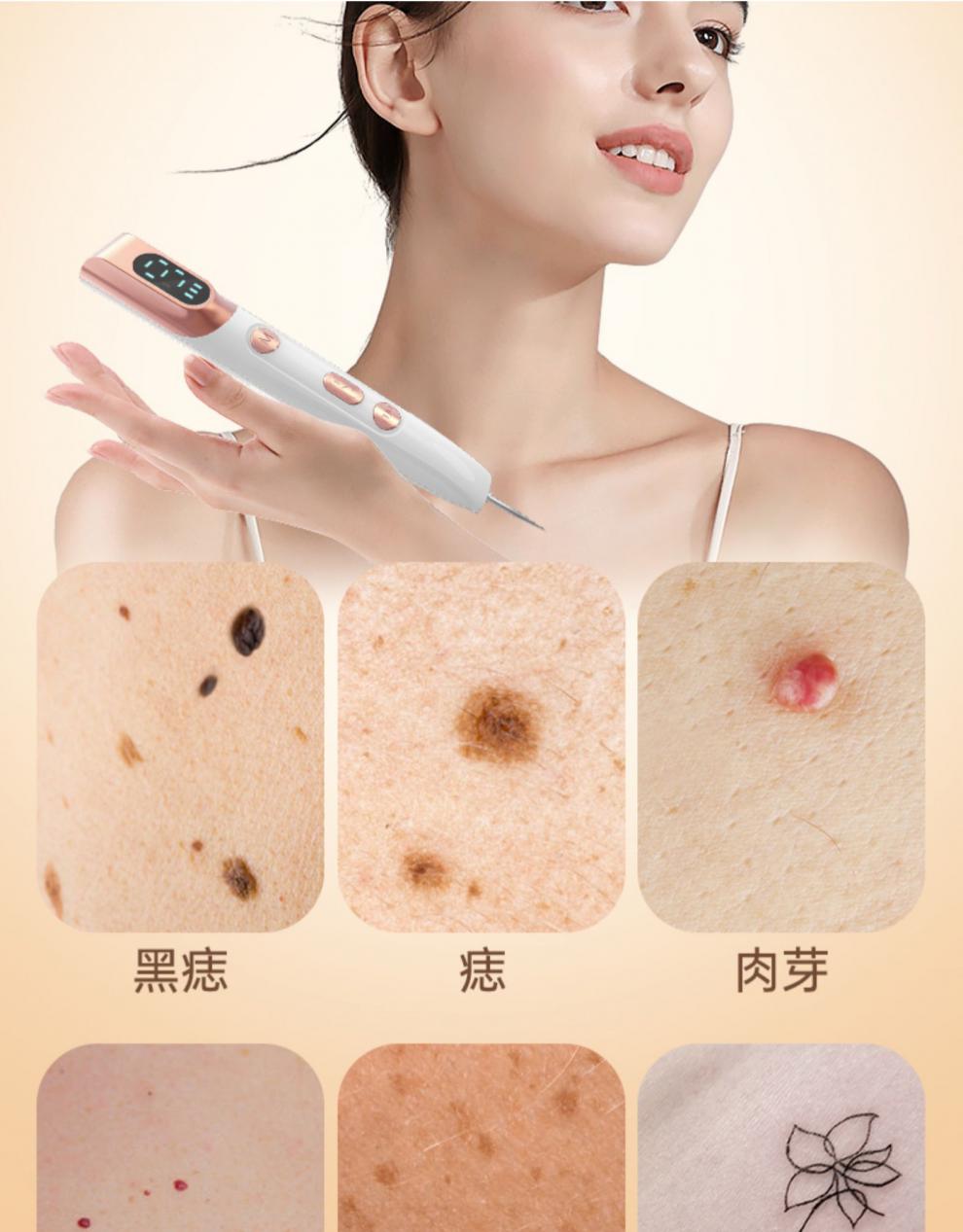 2022新款激光点痣笔小白美容院专用仪器点斑祛痣仪家用去斑去痣神器