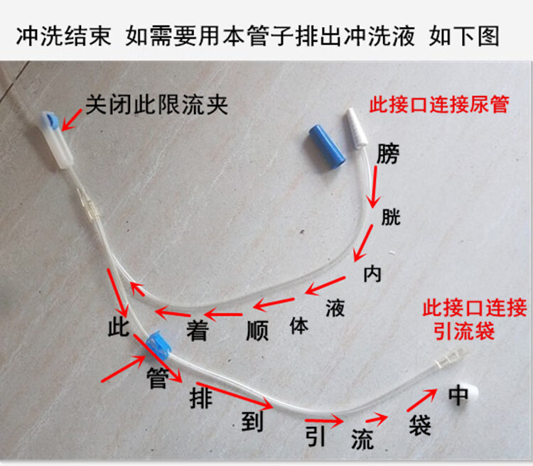 一次性使用膀胱冲洗器腹腔冲洗三腔导尿管膀胱注药连接器冲洗用10个装