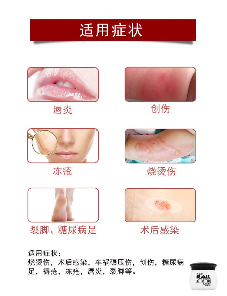 官方旗舰巴纳克玉肤膏唐山巴克愈肤膏真菌克星玉夫膏玉夫爽液玉夫膏