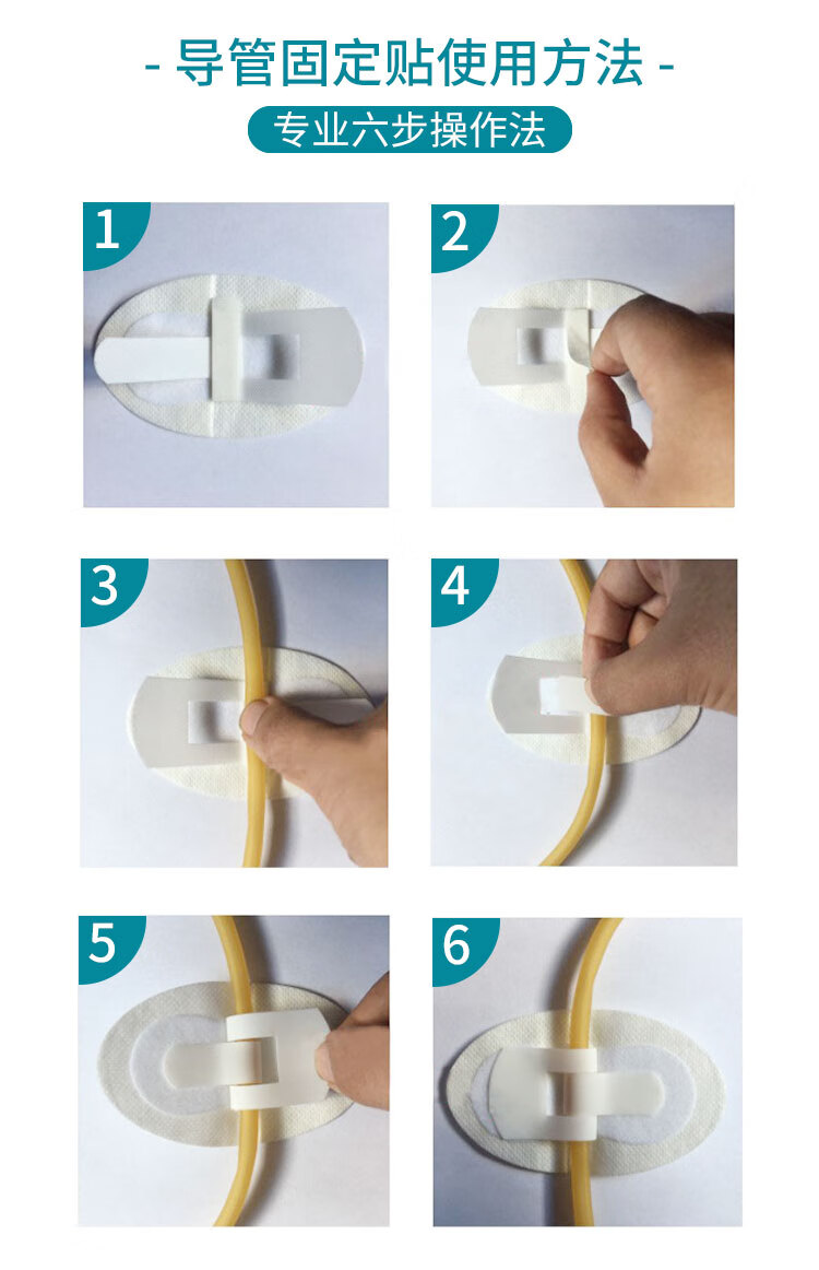 医用体表导管固定贴鼻梁贴导管胃管胶带固定胃管鼻饲管鼻贴鼻饲胶布贴