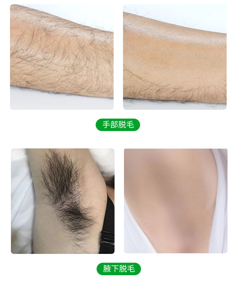胡子脱毛膏男士脱胡子胡须脸部腿毛全身可用半剃须膏脱毛抑毛两套装