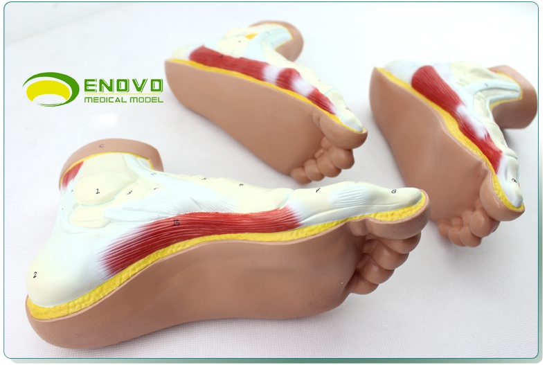 enovo颐诺正常足扁平足弓形足高弓足模型脚足弓模型医学教学用运动