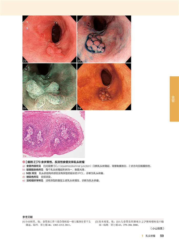 京东自营 正版 胃肠诊断图谱1 上消化道 第2版