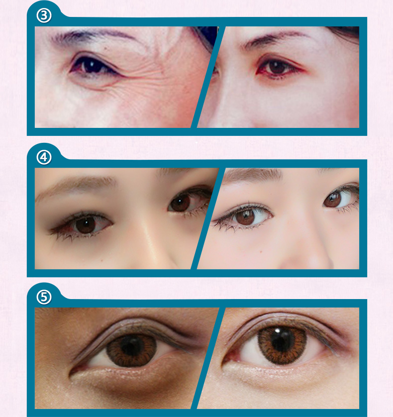 金泰康蒸汽眼罩5盒40片眼贴膜热敷眼部护理细纹眼袋睡眠薰衣草香型