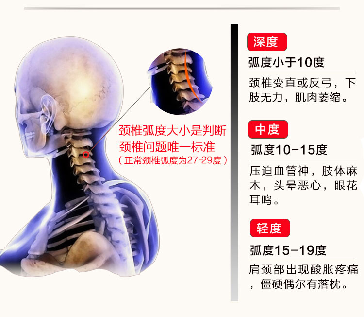 元宝型颈椎枕头牵引矫正反弓曲度变直脊椎睡枕