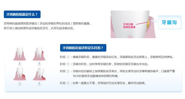 主体 品牌 狮王 类型 牙刷 功能 软毛 原产地 日本 特殊用途 超小刷头