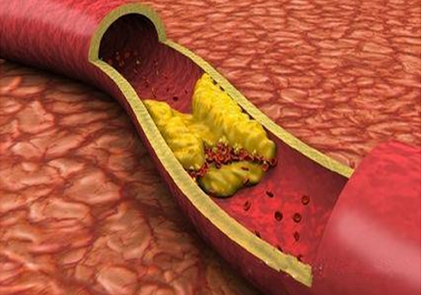 中年血液粘稠危害大!每天一点它,清理血管垃圾更健康