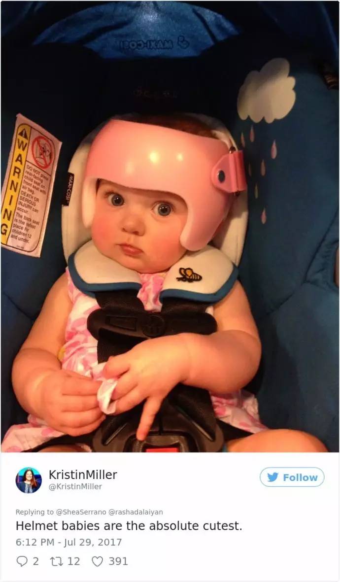3岁宝宝头型矫正头盔图片