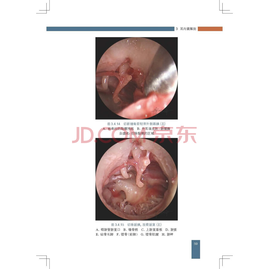 耳內鏡解剖圖譜