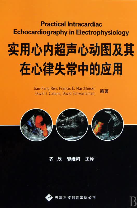 实用心内超声心动图及其在心律失常中的应用(精)