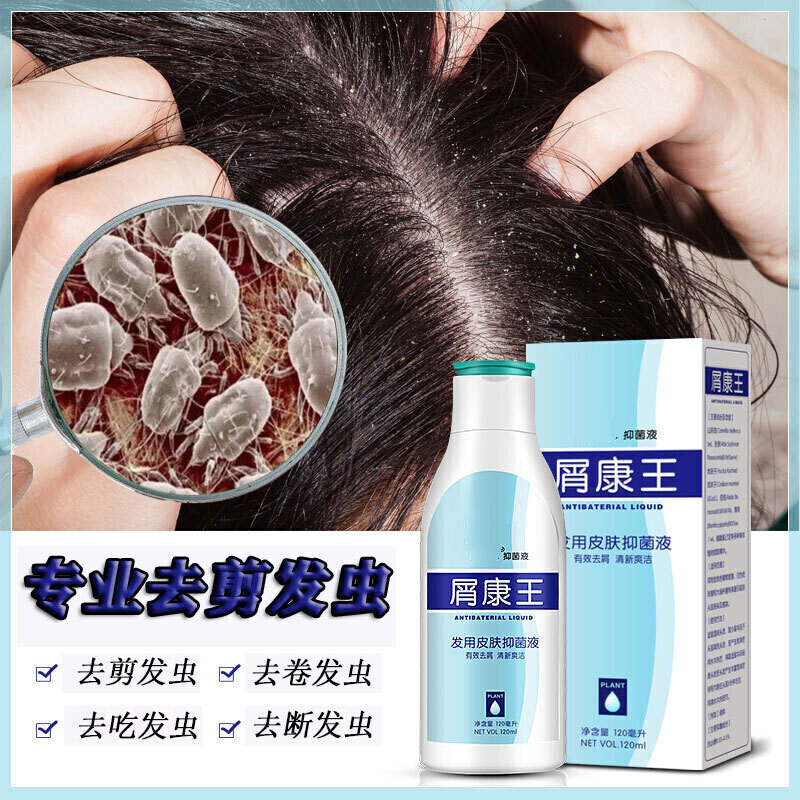去卷发虫除吃发虫防掉发中儿童缠发断发除螨虫剪发虫洗发水二瓶240ml
