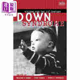 唐氏综合症 21世纪展望 Down Syndrome: Visions For The 21St Century 英文原版 William Cohen Wiley