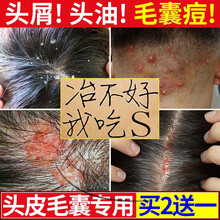 除头螨洗发水新款 除头螨洗发水21年新款 京东