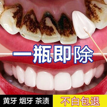 洗牙粉推荐新款 洗牙粉推荐21年新款 京东 洗牙粉推荐新款 洗牙粉推荐21年新款 京东