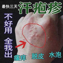 季节性脱皮型号规格 京东 季节性脱皮型号规格 京东