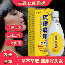 脂溢性头皮洗发水新款 脂溢性头皮洗发水21年新款 京东