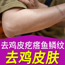 倍润清去鸡皮疙瘩图片(倍润清去鸡皮一套多少钱)