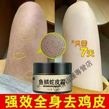 鸡皮疙瘩和蛇皮肤能冶好不(腿上都是蛇皮和鸡皮疙瘩怎么治)