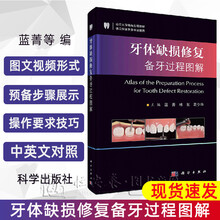 嵌体价格报价行情 京东