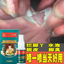 脚丫脱皮不痒 京东 脚丫脱皮不痒 京东