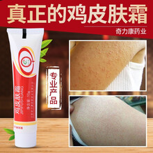 手臂起鸡皮价格报价行情 京东