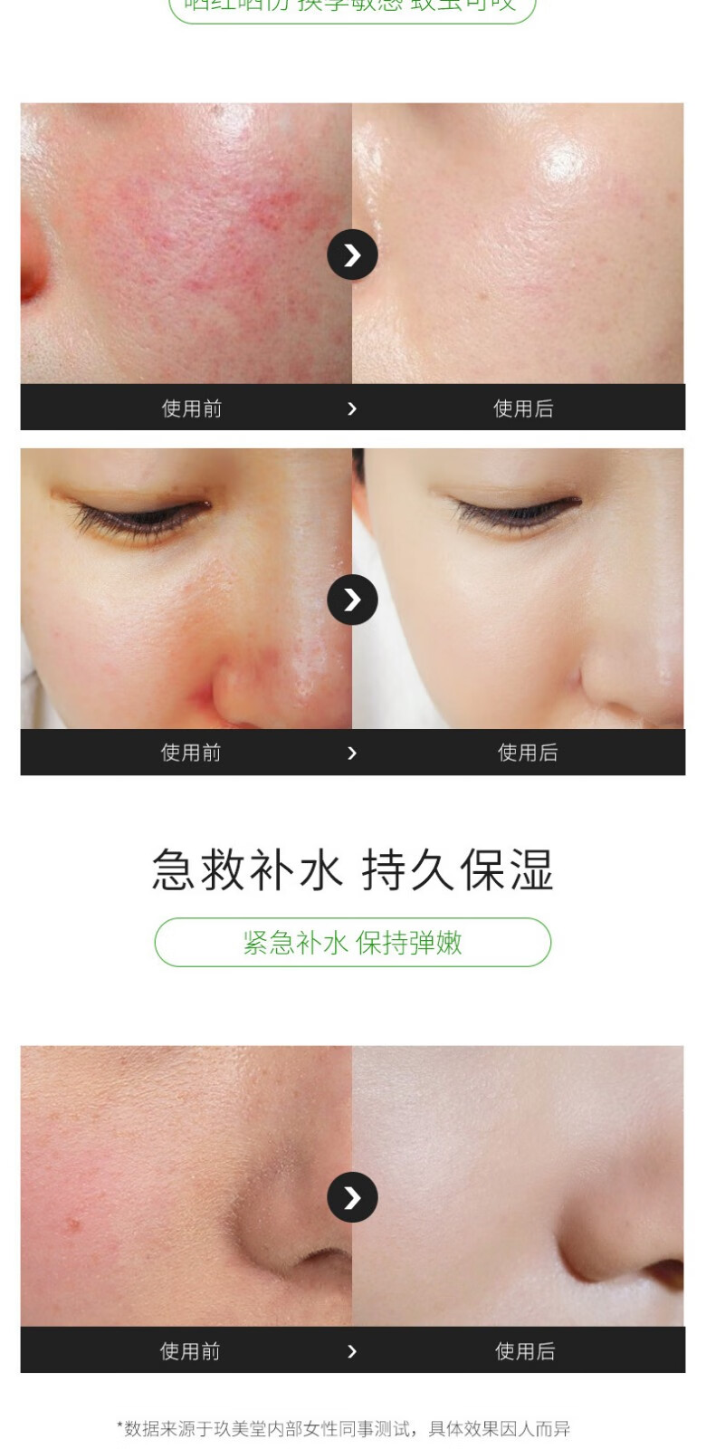 水润胶囊芦荟胶收缩毛孔祛痘补水保湿乳液面部护理护肤品男女士面部