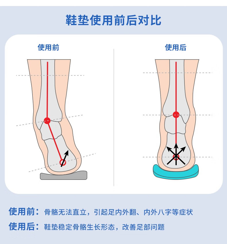 步步衡儿童高足弓矫正内八字足内翻纠正鞋垫小孩xo型腿 正常足 36码