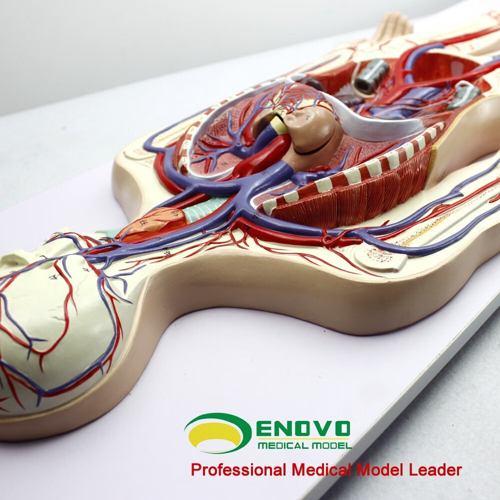 颐诺 医学人体心脏模型冠状动脉血栓动脉硬化体外循环心血管介入心脏