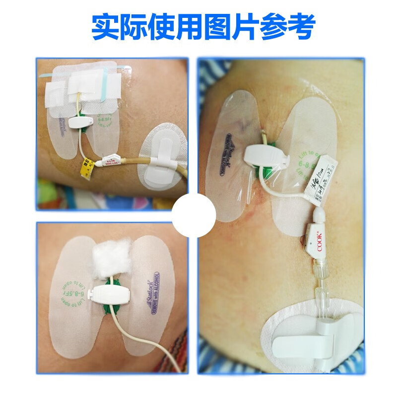 美国巴德引流管固定装置胆汁胆管造瘘蝴蝶卡扣固定贴进口思乐扣ptcd