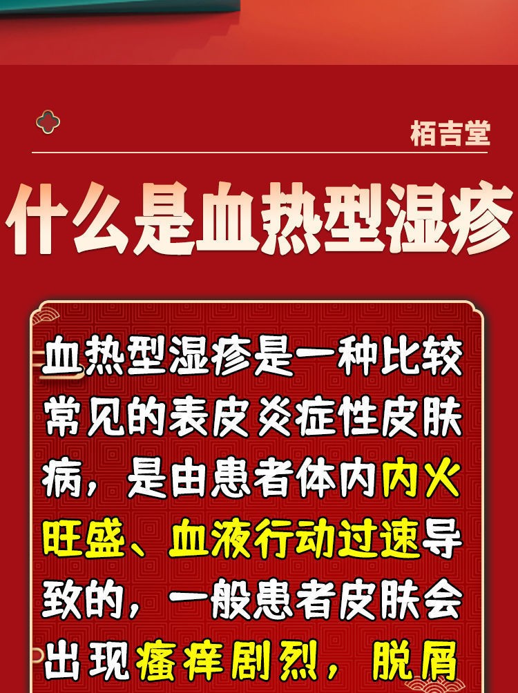 栢吉堂治风疹湿疹荨麻疹的药身上起红点红斑团疙瘩