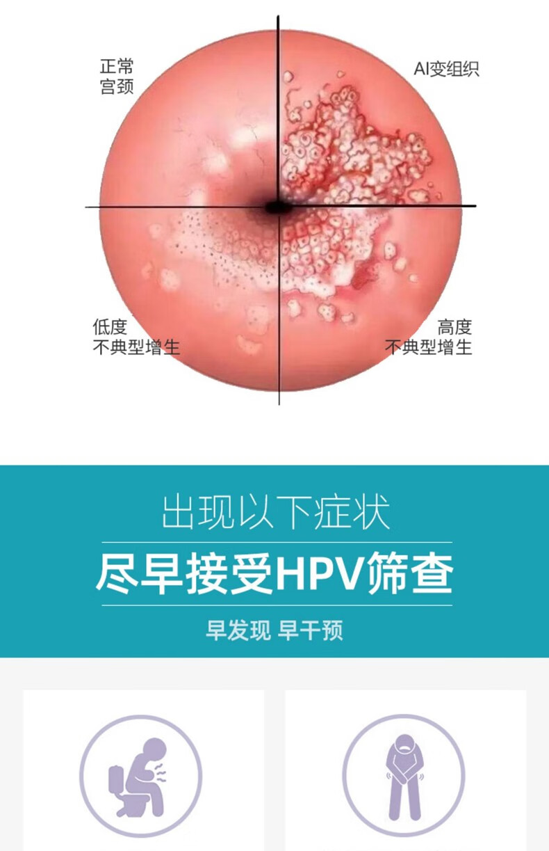 hpv病毒凝胶 阻断高危型hpv感染预防宫颈病变高危感染生物蛋白敷料抑