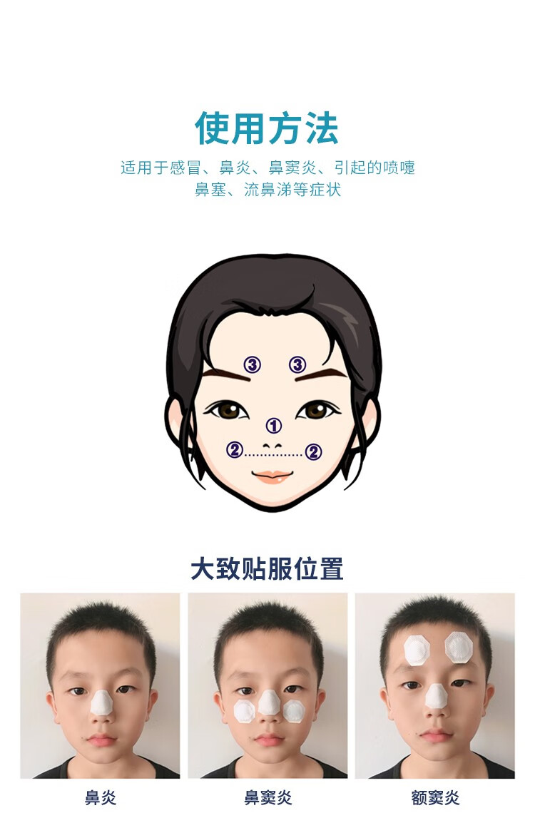 群泰 优元康 鼻炎穴位贴 成人儿童过敏性鼻炎流鼻涕鼻干鼻痒打喷嚏